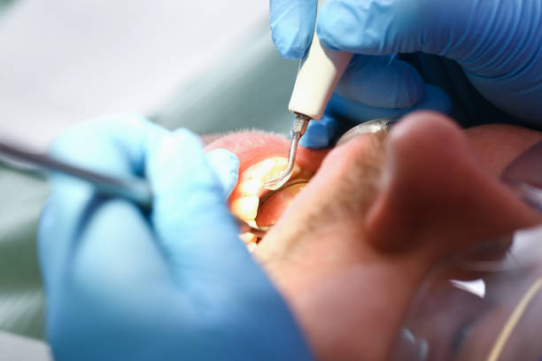 Best Broken or Cracked Tooth Emergency Dentist in Mount Carmel, IL